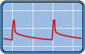 Der ewige Blinker