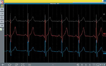 Elektor Android EKG (1)