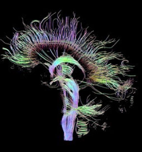 Neurociencia cognitiva y música